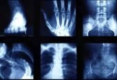 Perfecare Diagnostics