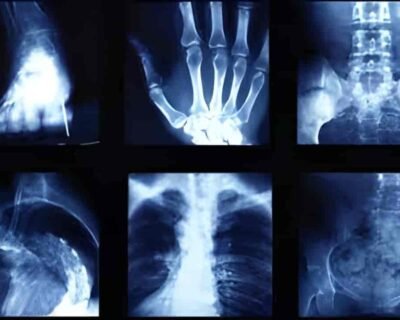 diagnostic-centre-x-ray-022pxx22.xx22.190510132552.v9t3-4h002xg