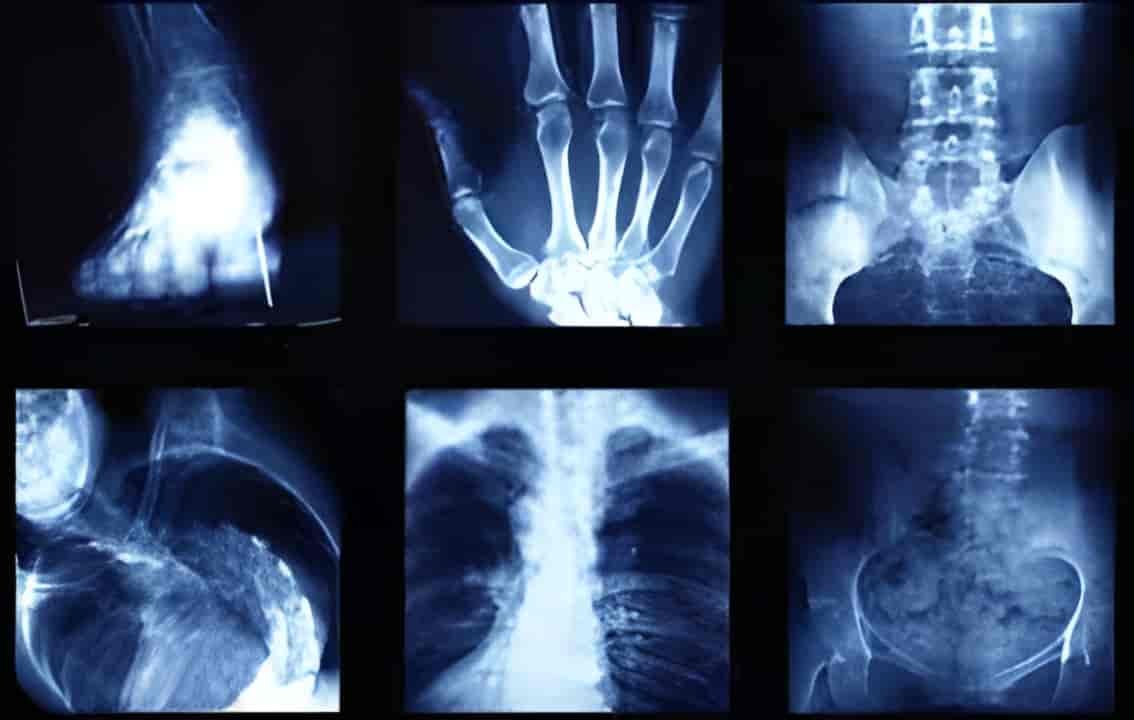 Perfecare Diagnostics