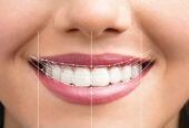 Shree Dental Clinic